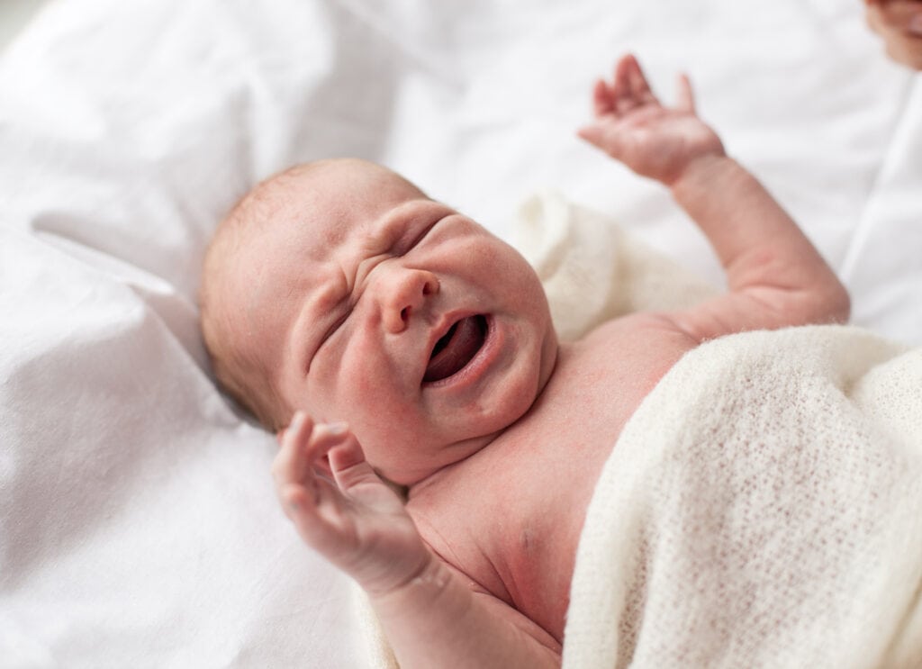 Baby with infant jaundice crying