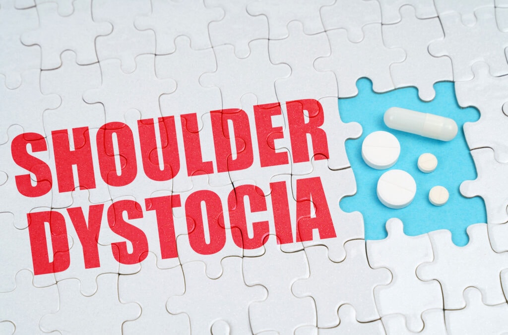 shoulder dystocia graphic