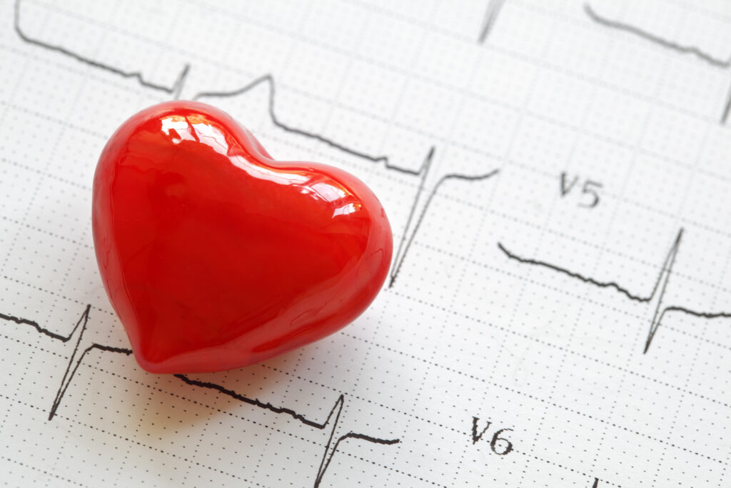 failure to diagnose heart attack